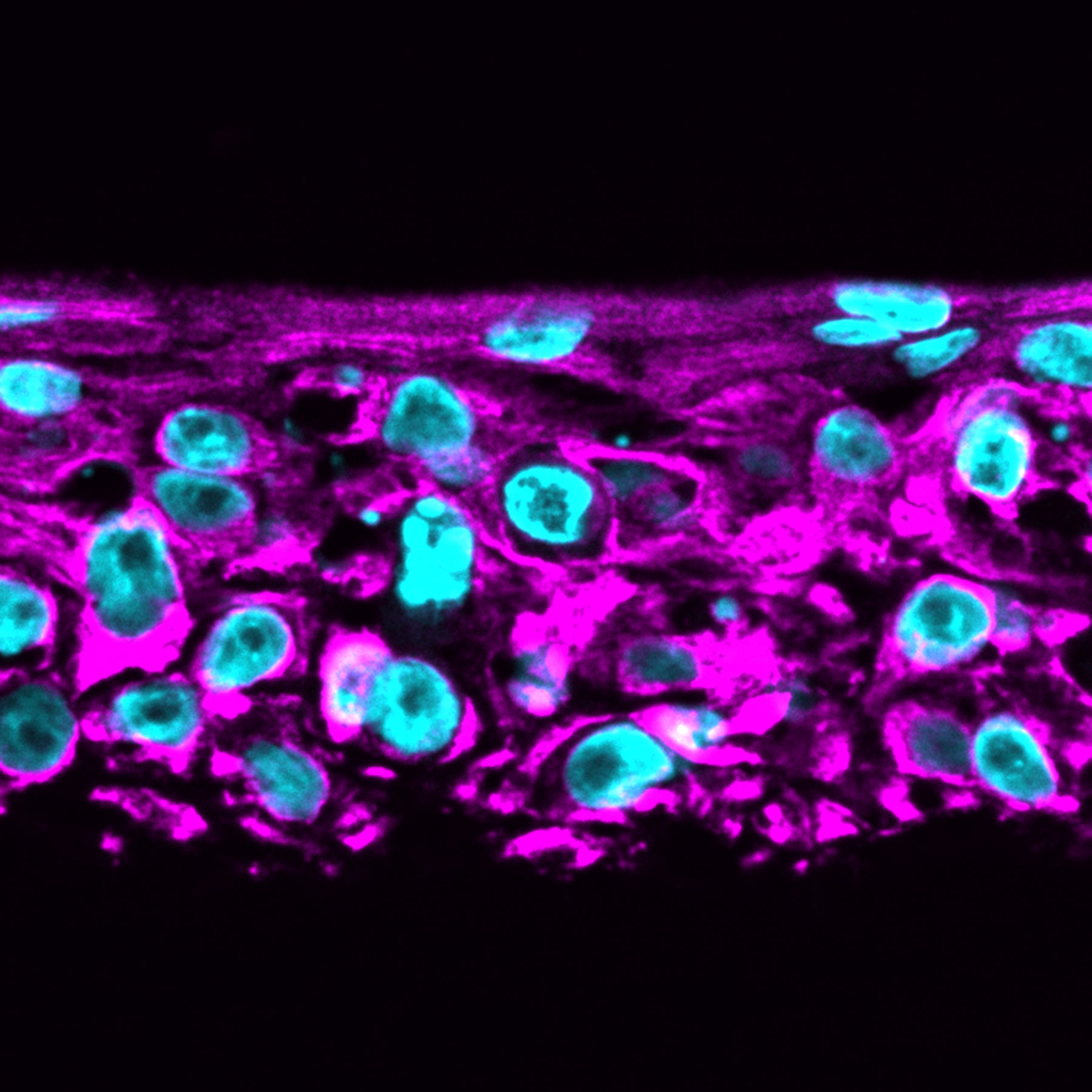Image of keratin 14 in organoid skin