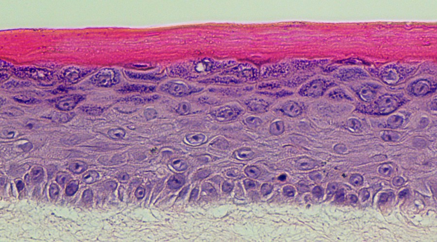 Image of epidermal histology